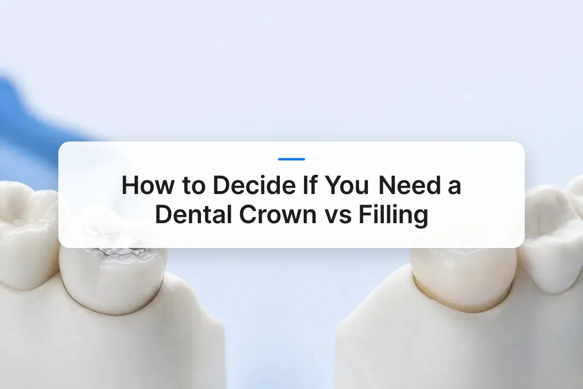 crown vs filling overview
