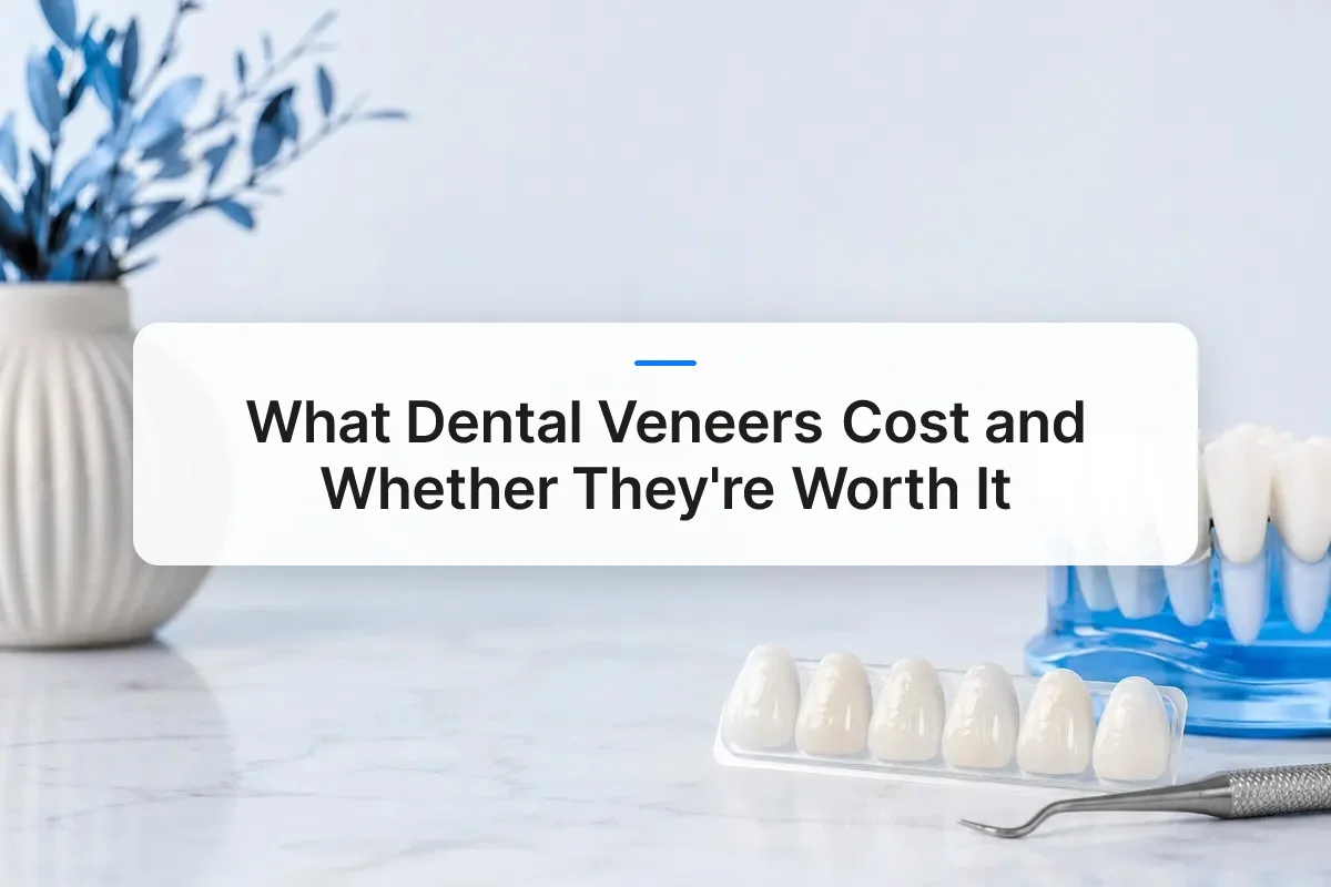 dental veneers cost overview