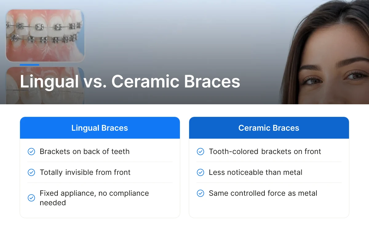 Lingual vs. Ceramic Braces
