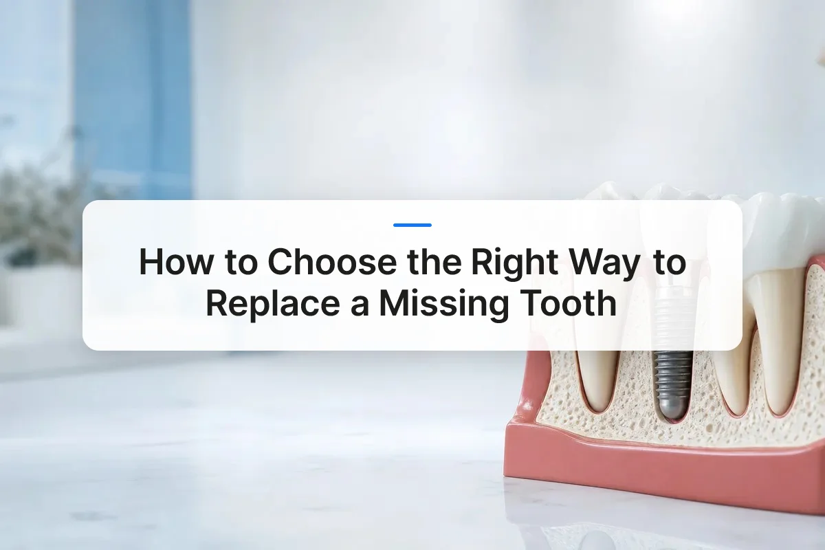 missing tooth replacement overview