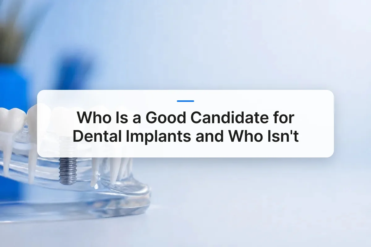 dental implants overview